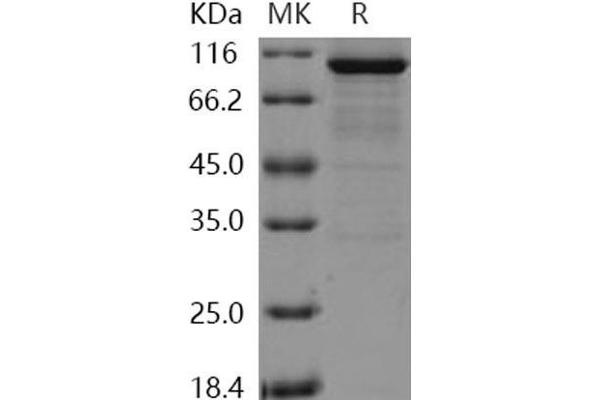 DCLK1 Protein (AA 1-705) (GST tag,His tag)