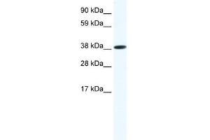 Western Blot showing OBOX6 antibody used at a concentration of 1-2 ug/ml to detect its target protein. (OBOX6 Antikörper  (Middle Region))