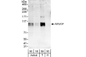Western Blotting (WB) image for anti-Armadillo Repeat Gene Deleted in Velocardiofacial Syndrome (ARVCF) (AA 75-125) antibody (ABIN7453257)