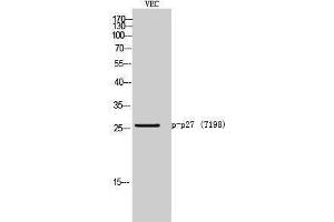 Western Blotting (WB) image for anti-P27 (pThr198) antibody (ABIN3182256) (P27 (pThr198) Antikörper)