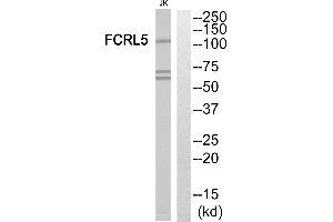 Western blot analysis of extracts from Jurkat cells, using FCRL5 antibody. (FCRL5 Antikörper  (Internal Region))