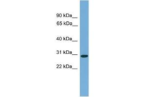 WB Suggested Anti-C20orf201 Antibody Titration: 0. (C20orf201 Antikörper  (C-Term))
