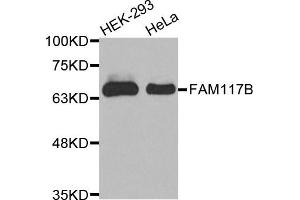 Western Blotting (WB) image for anti-Family with Sequence Similarity 117, Member B (FAM117B) antibody (ABIN1875633) (FAM117B Antikörper)