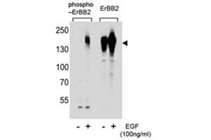 Western blot analysis of extracts from A431 cells, untreated or treated with EGF, using phospho-HER2 antibody (left) or nonpho Ab (right).