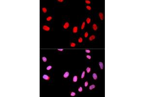 Immunofluorescence analysis of U2OS cell using CDC25C antibody. (CDC25C Antikörper  (AA 174-473))