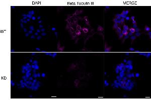 Immunocytochemical staining of Hela cells using Beta Tubulin III antibody (ABIN7800669), 1:1,000), Top panel: wild-type (WT), Bottom panal: Beta Tubulin III shRNA knockdown (KD). (Rekombinanter TUBB3 Antikörper)