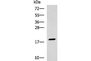 Western blot analysis of Human muscle tissue lysate using TNNC2 Polyclonal Antibody at dilution of 1:400 (TNNC2 Antikörper)