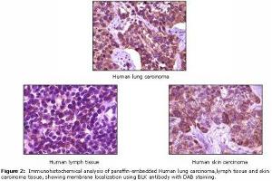 Image no. 1 for anti-B Lymphoid Tyrosine Kinase (BLK) antibody (ABIN232111) (BLK Antikörper)