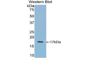 Western blot analysis of the recombinant protein. (VEGFB Antikörper  (AA 21-137))