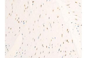 Immunohistochemistry (IHC) image for anti-Myc Proto-Oncogene protein (MYC) (pSer62) antibody (ABIN6255431)