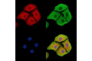ABIN7095409 and ABIN7099466 staining Hela cells by IF/ICC.