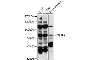 Western blot analysis of extracts of various cell lines, using FEM1A antibody (ABIN7267165) at 1:1000 dilution. (FEM1A Antikörper  (AA 100-300))
