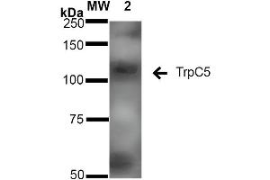 Western Blot analysis of Rat Brain Membrane showing detection of ~110 kDa TrpC5 protein using Mouse Anti-TrpC5 Monoclonal Antibody, Clone S67-15 . (TRPC5 Antikörper  (AA 827-845))