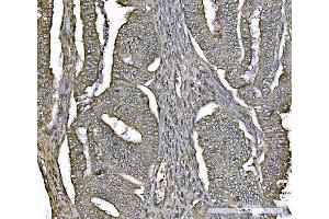 IHC analysis of PARK7/DJ1 using anti-PARK7/DJ1 antibody (ABIN7600468). (PARK7/DJ1 Antikörper  (AA 2-189))