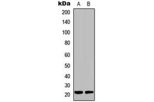 Western blot analysis of DUSP22 expression in HCT116 (A), Raw264. (DUSP22 Antikörper  (Center))