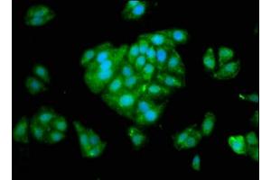 Immunofluorescence (IF) image for anti-serpin Peptidase Inhibitor, Clade A (Alpha-1 Antiproteinase, Antitrypsin), Member 6 (SERPINA6) (AA 23-405) antibody (ABIN7148621)
