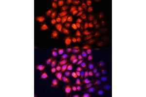 Immunofluorescence analysis of HeLa cells using IGF2 Polyclonal Antibody (ABIN6130483, ABIN6142237, ABIN6142238 and ABIN6218206) at dilution of 1:100 (40x lens). (IGF2 Antikörper  (AA 25-180))