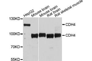 Western blot analysis of extracts of various cell lines, using CDH4 antibody. (Cadherin 4 Antikörper)