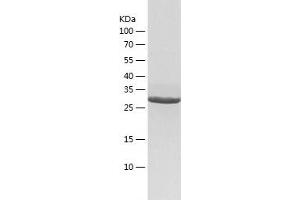 GGPS1 Protein (AA 1-300) (His tag)