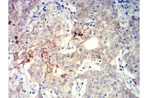 Immunohistochemistry (IHC) image for anti-Integrin beta 4 (ITGB4) (AA 29-206) antibody (ABIN5611133)