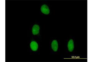 Immunofluorescence of purified MaxPab antibody to DBR1 on HeLa cell. (DBR1 Antikörper  (AA 1-544))
