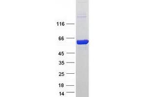 Western Blotting (WB) image for 5'-Nucleotidase, Cytosolic II (NT5C2) (Transcript Variant 2) protein (Myc-DYKDDDDK Tag) (ABIN2727659)