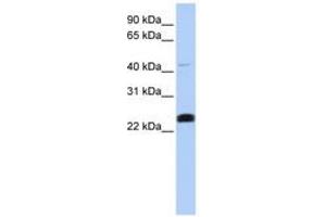 Image no. 1 for anti-Lysocardiolipin Acyltransferase 1 (LCLAT1) (C-Term) antibody (ABIN6743300)