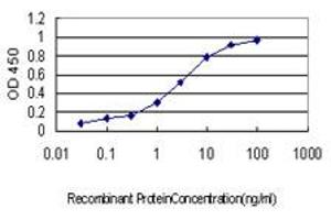 Detection limit for recombinant GST tagged CETN1 is approximately 0. (Centrin 1 Antikörper  (AA 1-100))