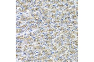 Immunohistochemistry of paraffin-embedded mouse stomach using STXBP2 antibody at dilution of 1:100 (x40 lens).