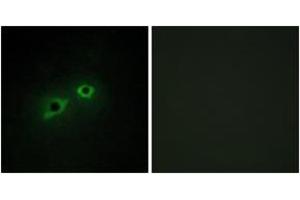 Immunofluorescence analysis of HepG2 cells, using ENTK Antibody. (TMPRSS15 Antikörper  (AA 81-130))