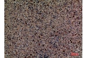 Immunohistochemical analysis of paraffin-embedded human-spleen, antibody was diluted at 1:100. (CD58 Antikörper  (Internal Region))