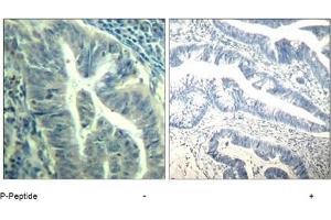 Image no. 3 for anti-Cyclin-Dependent Kinase 6 (CDK6) (pTyr24) antibody (ABIN319290) (CDK6 Antikörper  (pTyr24))