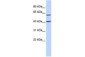 TCTN3 antibody used at 1 ug/ml to detect target protein. (TCTN3 Antikörper  (Middle Region))