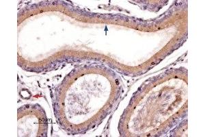 Immunohistochemistry (IHC) image for anti-Coagulation Factor II (Thrombin) Receptor-Like 3 (F2RL3) (AA 136-150), (C149S), (Extracellular) antibody (ABIN7043077)