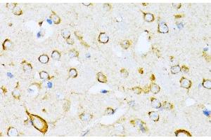 Immunohistochemistry of paraffin-embedded Mouse brain using VARS Polyclonal Antibody at dilution of 1:100 (40x lens). (VARS Antikörper)