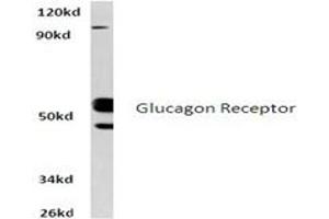 Image no. 1 for anti-Glucagon Receptor (GCGR) antibody (ABIN317704)