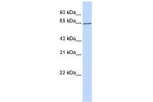 Image no. 1 for anti-Solute Carrier Family 2 (Facilitated Glucose Transporter), Member 13 (SLC2A13) (AA 396-445) antibody (ABIN6740857)