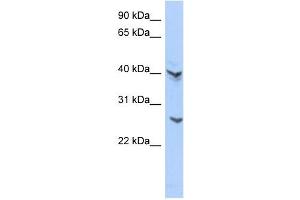 ATP6V0E2 antibody used at 1 ug/ml to detect target protein.