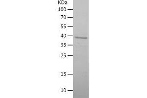 Western Blotting (WB) image for Uncoupling Protein 1 (Mitochondrial, Proton Carrier) (UCP1) (AA 1-183) protein (His-IF2DI Tag) (ABIN7125655) (UCP1 Protein (AA 1-183) (His-IF2DI Tag))