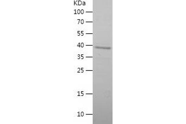 UCP1 Protein (AA 1-183) (His-IF2DI Tag)