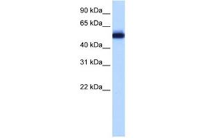 WB Suggested Anti-ZNF545 Antibody Titration:  0.