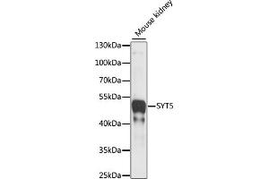 Western blot analysis of extracts of Mouse kidney, using SYT5 antibody (ABIN7270676) at 1:1000 dilution. (Synaptotagmin V Antikörper  (AA 1-110))