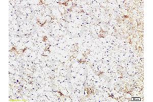 Formalin-fixed and paraffin embedded rat heart tissue labeled Anti-CTGF Polyclonal Antibody, Unconjugated (ABIN672636) at 1:200, followed by conjugation to the secondary antibody and DAB staining (CTGF Antikörper  (AA 221-349))