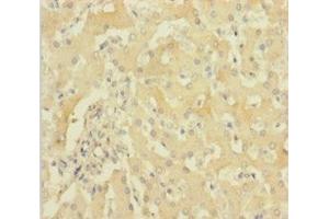 Immunohistochemistry of paraffin-embedded human liver tissue using ABIN7154984 at dilution of 1:100 (HBG1 Antikörper  (AA 2-147))