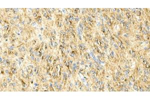 IHC analysis of GFAP using anti-GFAP antibody (ABIN7602675). (GFAP Antikörper  (AA 93-432))