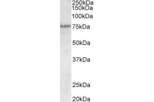 Western Blotting (WB) image for anti-Transformation Related Protein 63 (TRP63) (N-Term), (Trp63) antibody (ABIN2465086) (TRP63 Antikörper  (N-Term, Trp63))