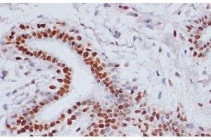 Immunohistochemistry (Paraffin-embedded Sections) (IHC (p)) image for anti-Histone H3 (H3) (acLys14), (acLys18), (acLys23), (acLys27), (acLys9) antibody (ABIN7259751)