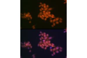 Immunofluorescence (IF) image for anti-Wings Apart-Like Protein Homolog (WAPAL) antibody (ABIN7271380)