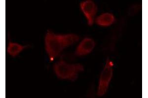 ABIN6274390 staining Hela cells by IF/ICC. (AGPAT9 Antikörper  (Internal Region))