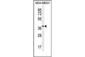 Western blot analysis of FOXA2 / HNF3B Antibody (Center) in MDA-MB231 cell line lysates (35ug/lane).
